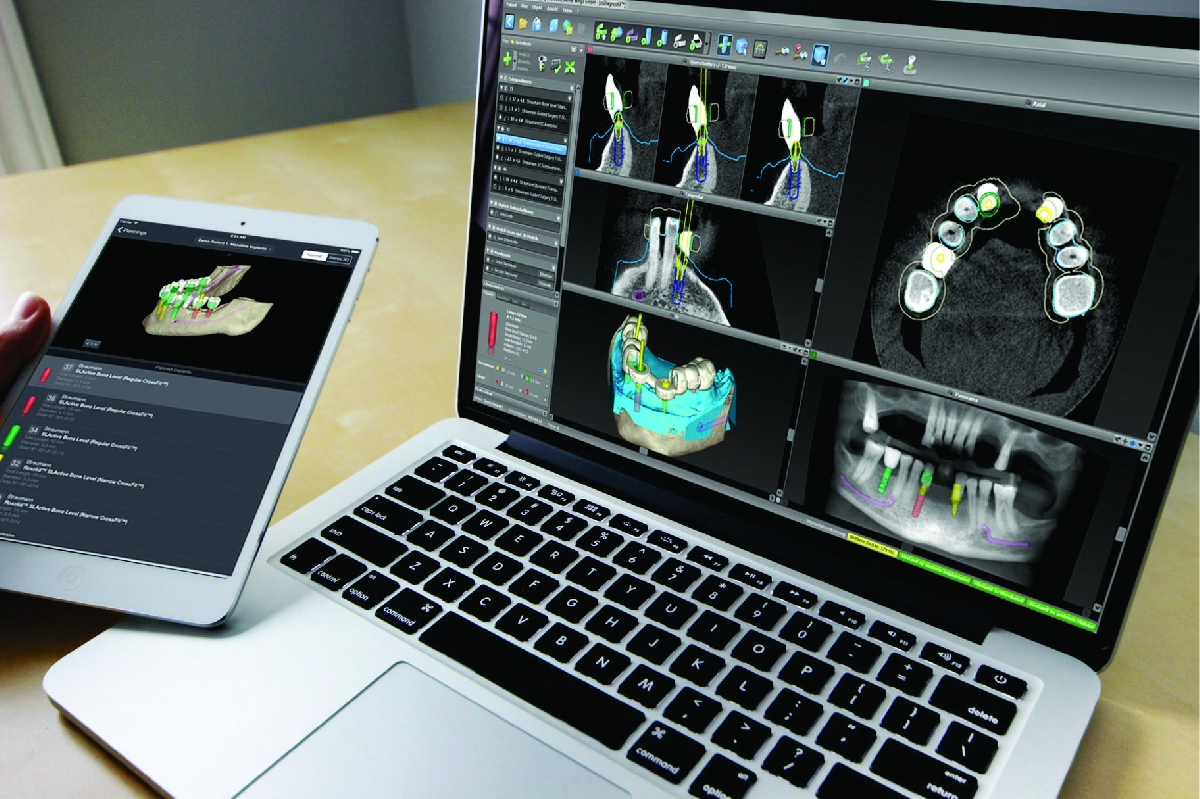 La era digital en la implantología