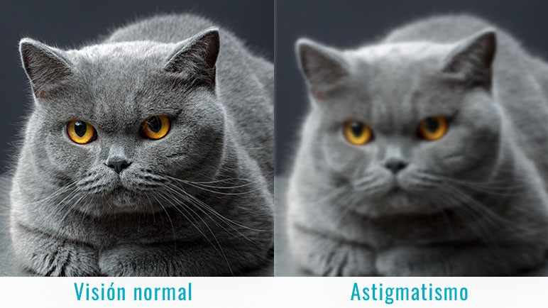 Qué es el astigmatismo